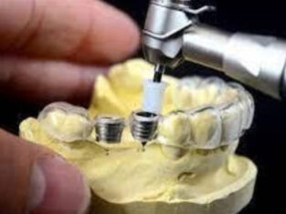 Benefits of Dental Implant Surgical