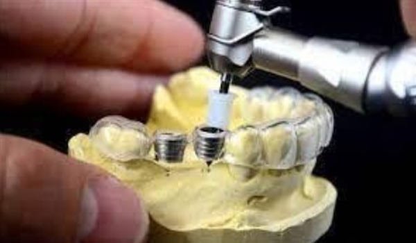 Benefits of Dental Implant Surgical